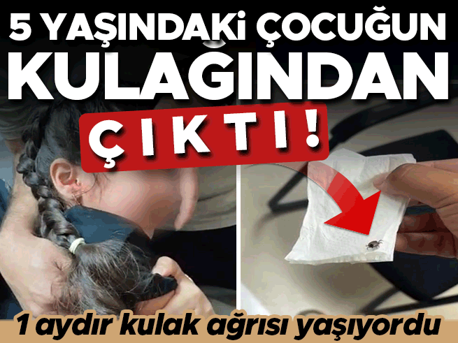 1 Aydır Kulak Ağrısı Çekiyordu: 5 Yaşındaki Çocuğun Kulağından Canlı Kene Çıkarıldı