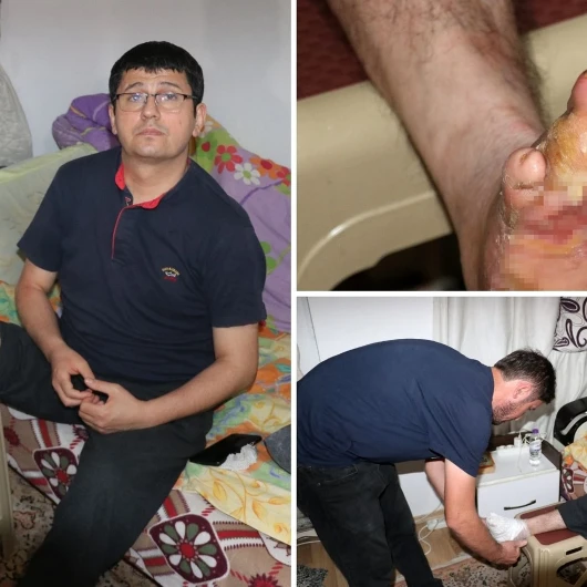 19 yıldır ayağındaki yaraya çare arıyor: 'Tanı koyulsun, tedavi olmak istiyorum