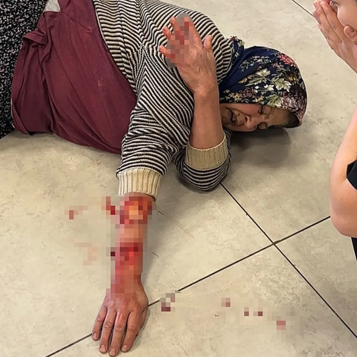 Afyonkarahisar'daki dinlenme tesisinde başıboş köpek saldırısı: Bir kadın ağır yaralandı