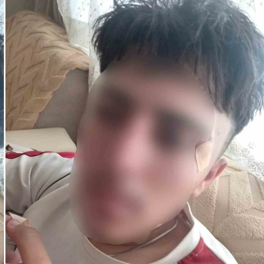 Afyonkarahisar'da Öğretmenden Öğrenciye Şiddet: Burnu Kırıldı