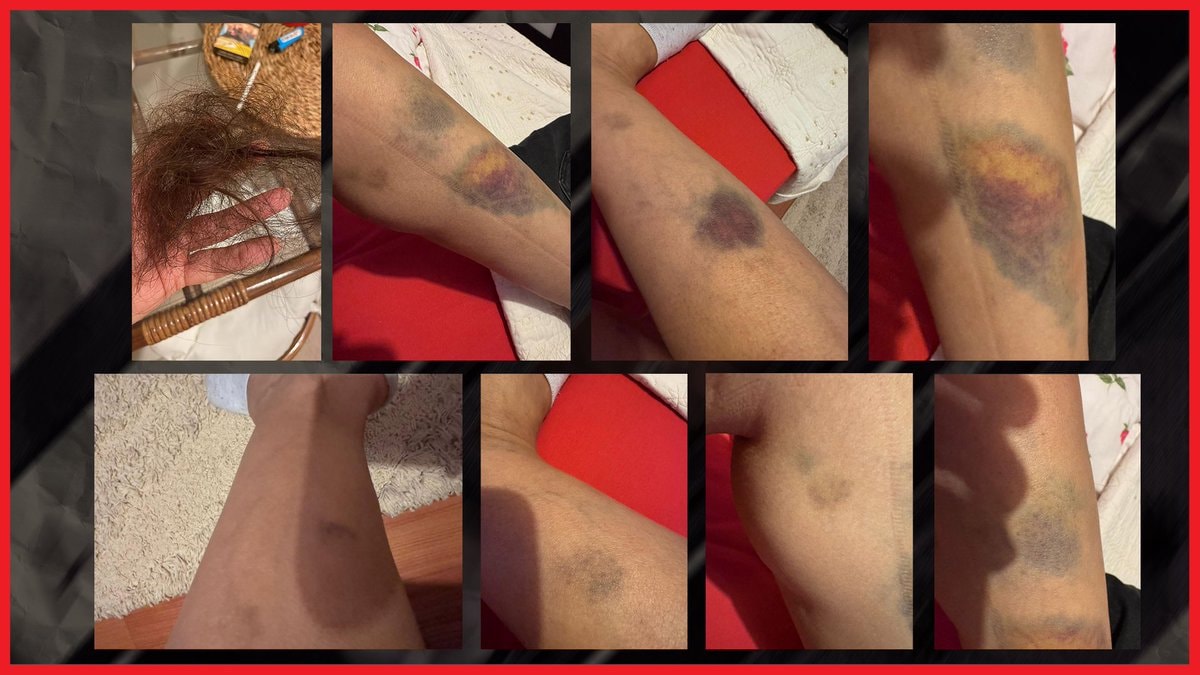 AKP'li Besli'nin istifası: Sevgilisini dövdü, hapis cezası aldı