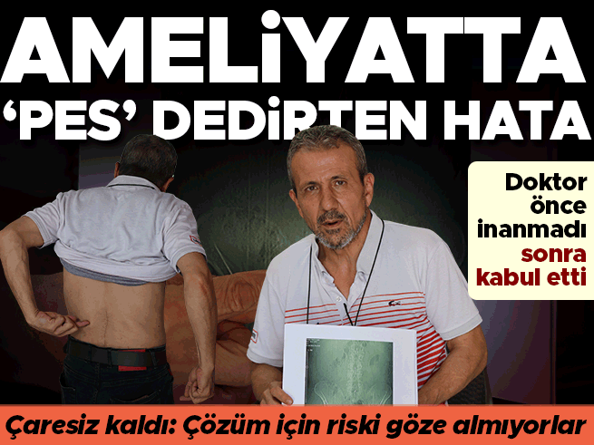 Ameliyatta akılalmaz ihmal: Belinde panç unuttular