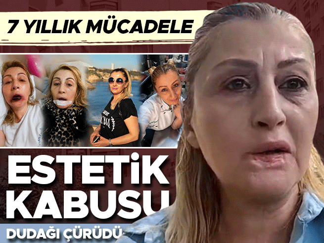 Antalya'da estetik kabusu: Dudağını kaybeden kadının 7 yıllık hukuk savaşı