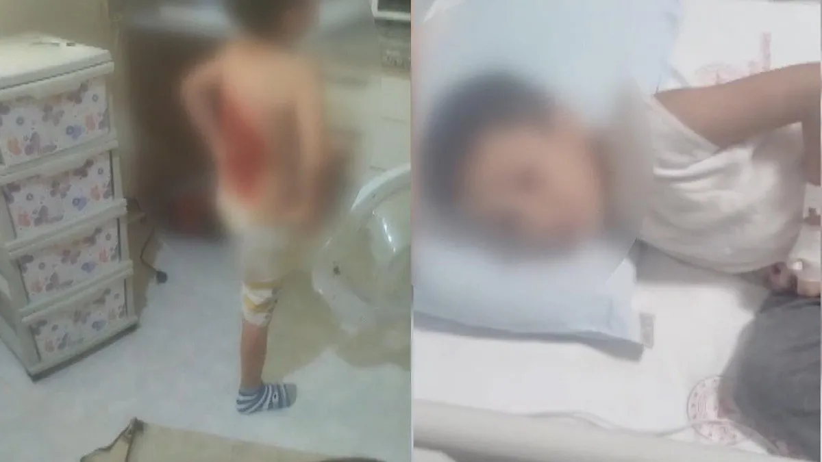 Arnavutköy'de 12 yaşındaki çocuğun sırtı kolonyayla yakıldı