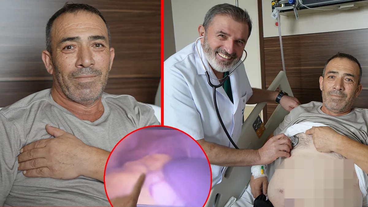 Bağırsak Kanseri Tedavisi İçin Gittiği Hastanede 54 Yıllık Sırrı Ortaya Çıktı