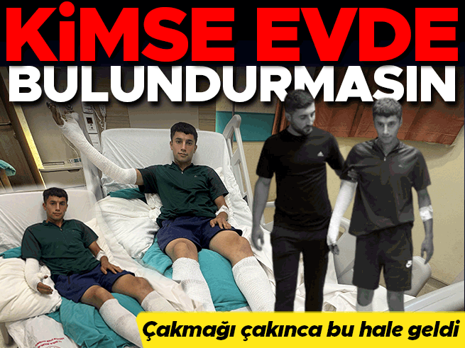 Çakmak Şakası Faciayla Bitti: Balata Spreyi Alev Aldı, 18 Yaşındaki Genç Yaralandı
