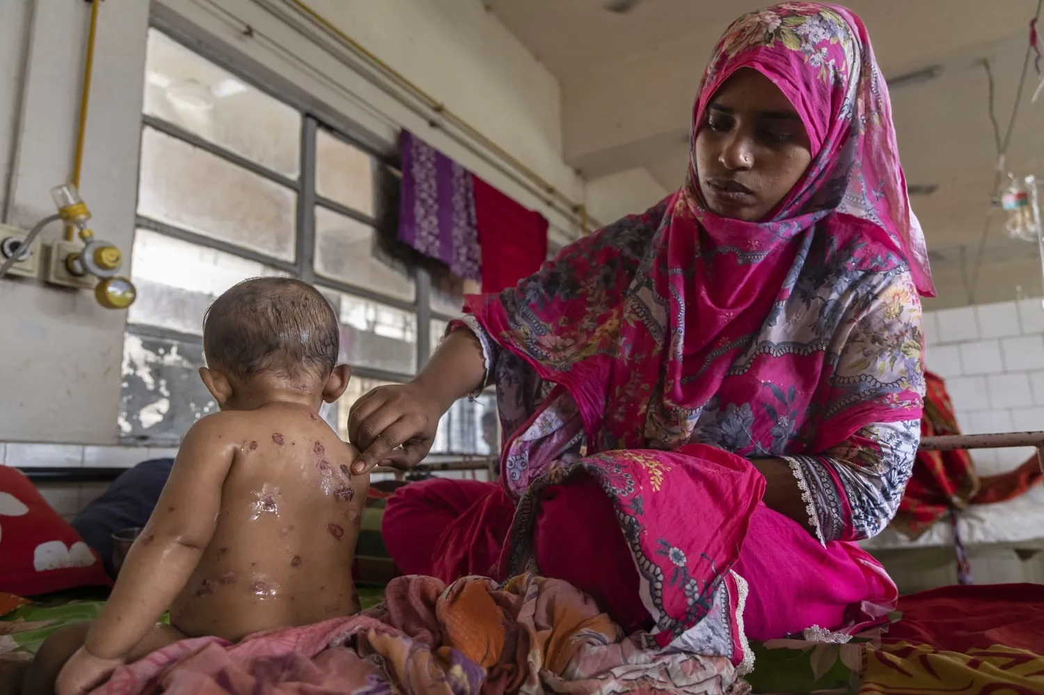 Bangladeş'te kızamık salgını: Can kaybı 712'ye çıktı