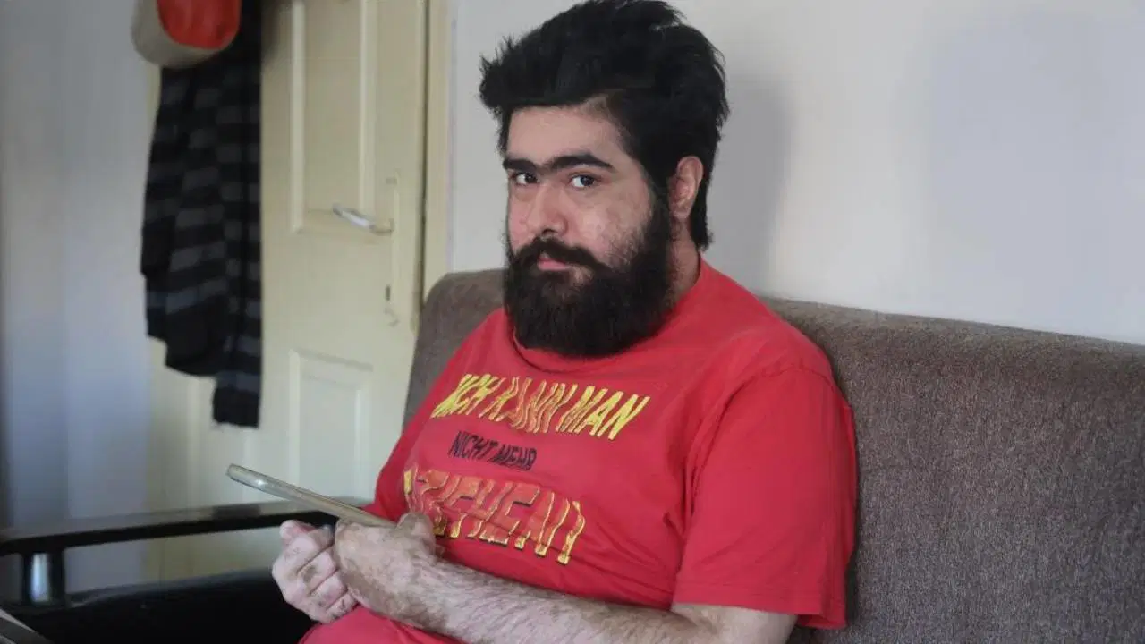 Barış 3 yıl sonra evinden çıktı, tedaviyi reddetti: 'Düzelmek istemiyorum