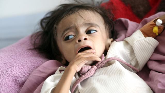 BM'den Yemen Uyarısı: İnsani Kriz Derinleşiyor