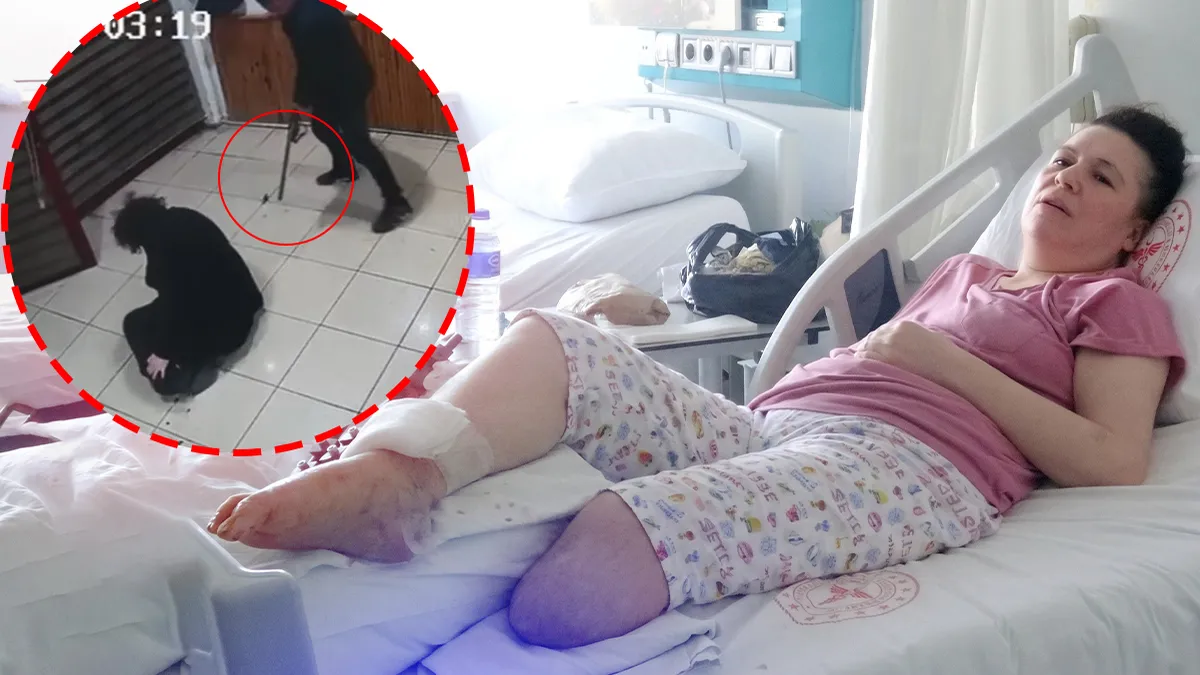 Boşanma aşamasındaki eşine kurşun yağdırdı: Bacağını kaybeden kadın anlattı