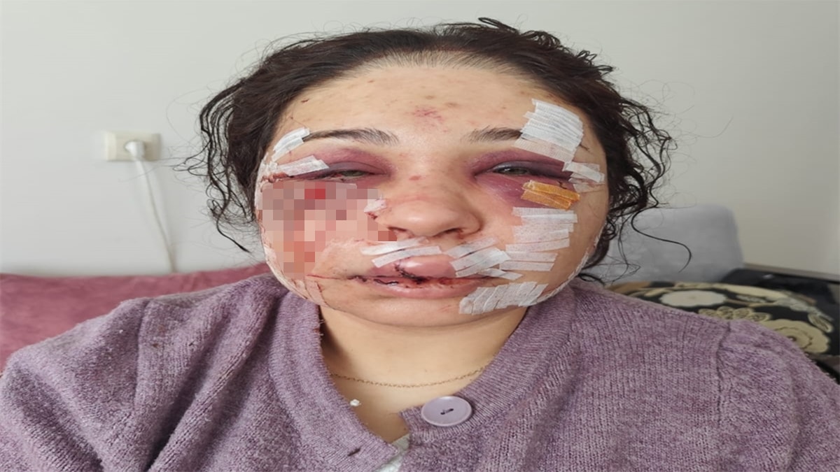 Boşanma Aşamasındaki Eşini Darbeden Polis Memuru Tahliye Edildi