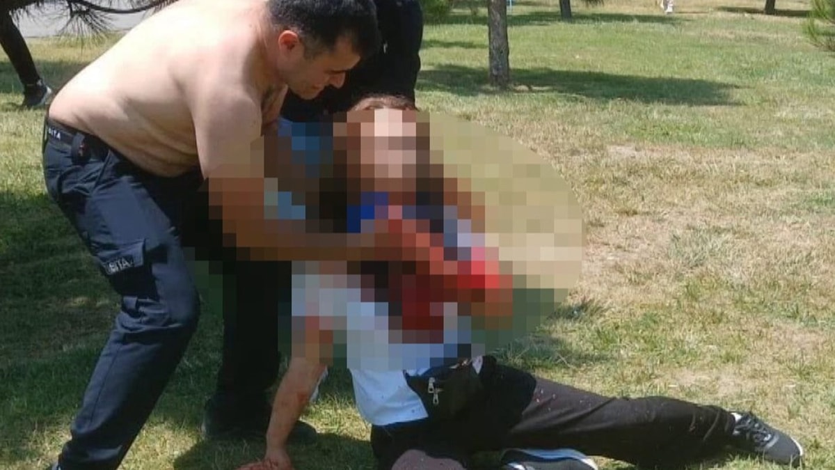 Boşanma aşamasındaki eşini parkta boğazından bıçakladı
