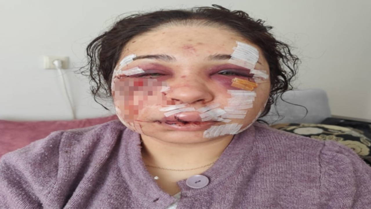 Boşanma aşamasındaki eşini darbeden polis tahliye edildi: İndirimler tepki çekti