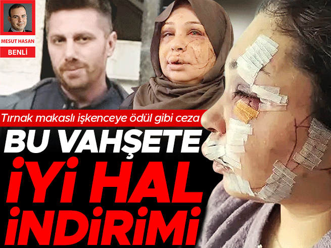 Boşanma Aşamasındaki Eşine İşkence: Polise İyi Hal İndirimi Tepki Çekti