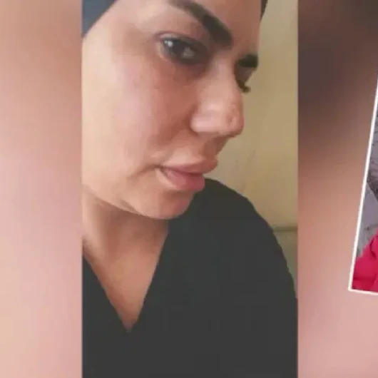 Burun Estetiği Dehşeti: 4 Ameliyat Sonrası Perişan Oldu