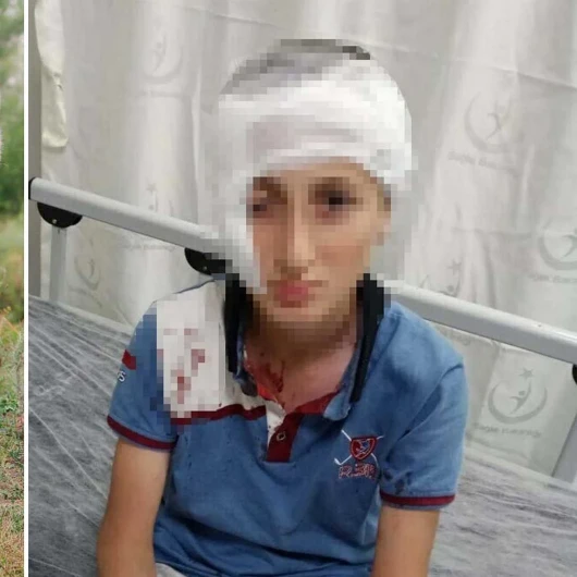 Çocuğa köpek saldırısında emsal karar: 1,2 milyon TL tazminat