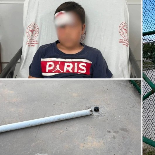 Çocuk parkındaki direk faciası: 10 yaşındaki çocuk yaralandı