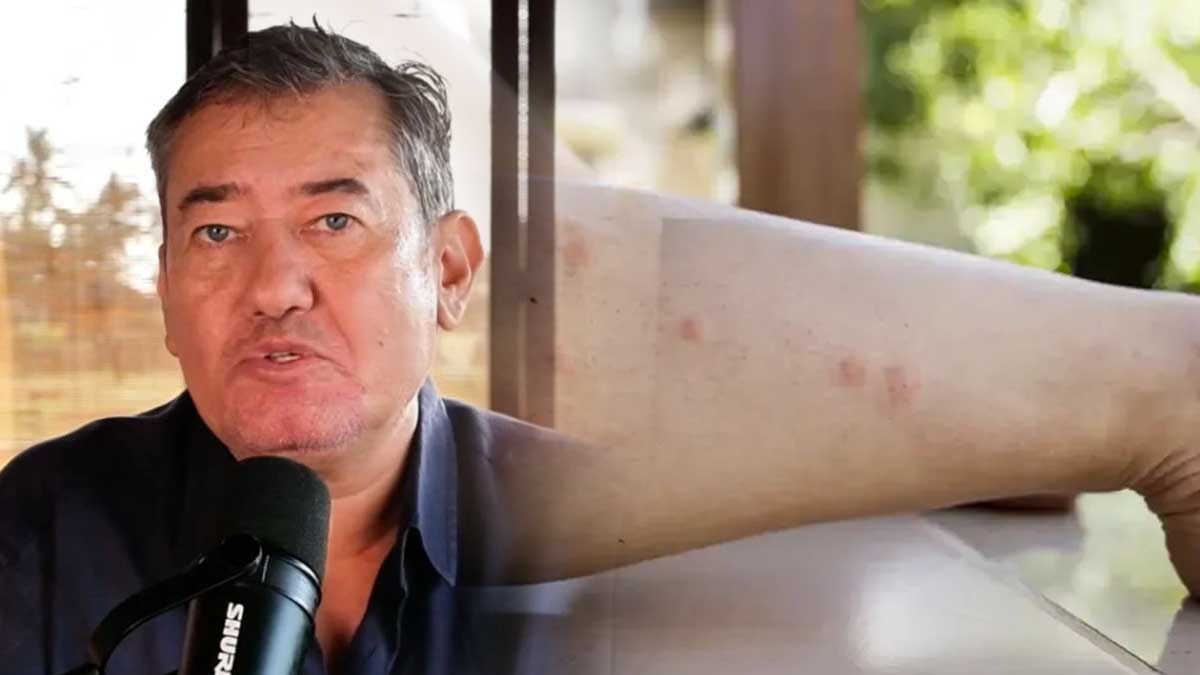 Dang Humması Nedir? Gazeteci Serdar Akinan'ın Hastalığı ve Ölümcül Riskleri
