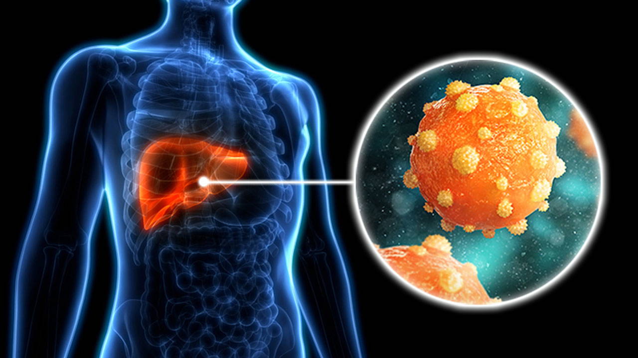 Dünya Hepatit Günü: 300 Milyon Kişi Virüsle Mücadelede