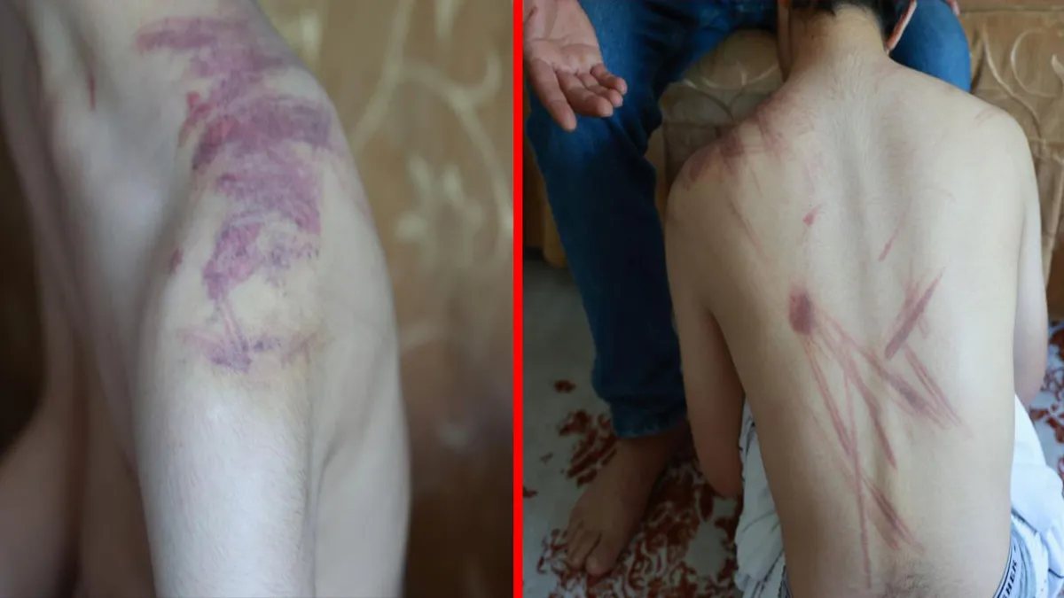 Elazığ'da engelli çocuğa şiddet: Baba adliyeye başvurdu