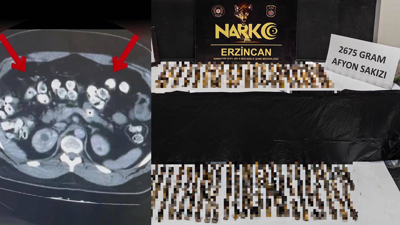 Erzincan'da Afyon Sakızı Operasyonu: 3 Tutuklama