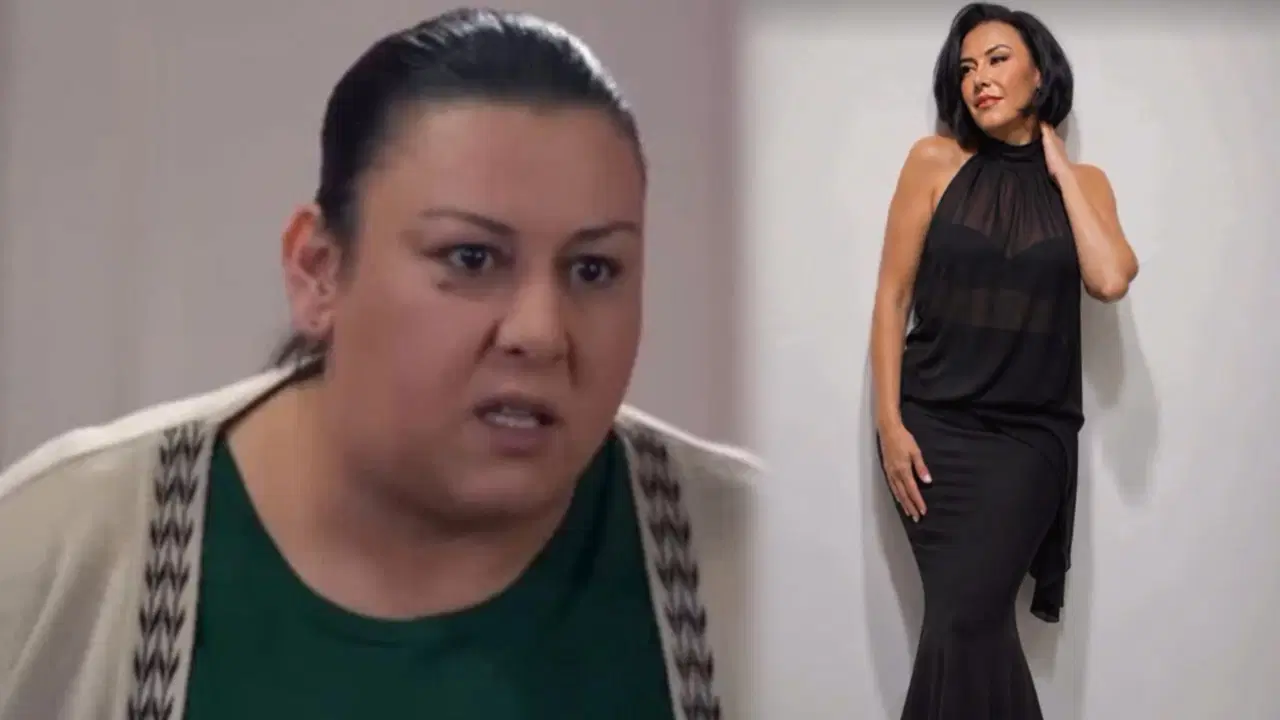 Esin Gündoğdu'nun 72 kilo verdikten sonra ortaya çıkan sağlık sorunu