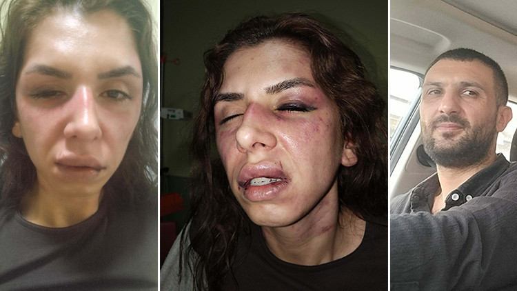 Eşine şiddet uygulayan kocaya 11,5 yıl hapis istemi
