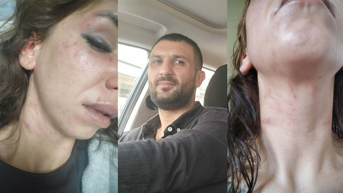 Eşini Öldüresiye Döven Kocaya 11 Yıl Hapis Cezası