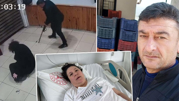 Eşini Vurup Bacaklarını Kaybettirdi: 'Sevdiğim İçin Oldu' Savunması