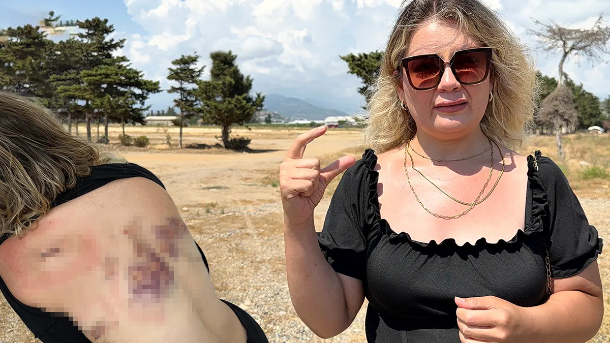 Eski sevgilisi 30 yerinden bıçakladı: Bıçak sırtımda kırılmasa can vermiştim