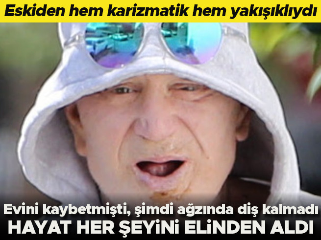 Eskiden karizmatik ve yakışıklıydı: Hayat ondan her şeyini aldı