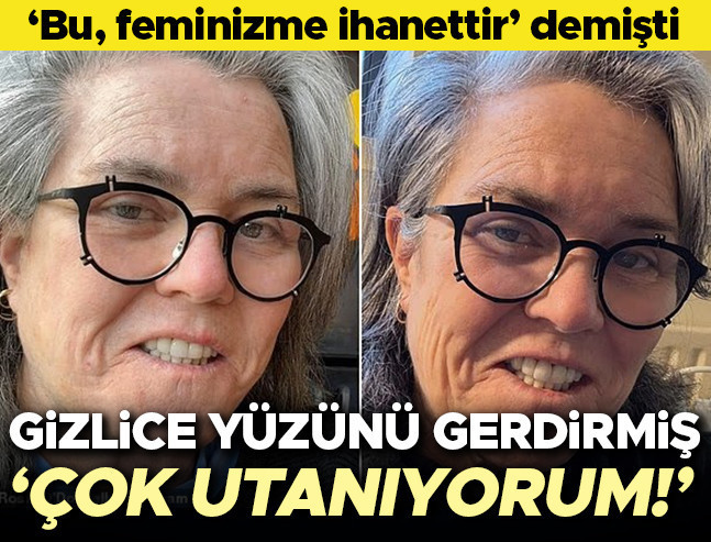 Feminizme ihanet demişti, gizlice yüzünü gerdirdi: Çok utanıyorum
