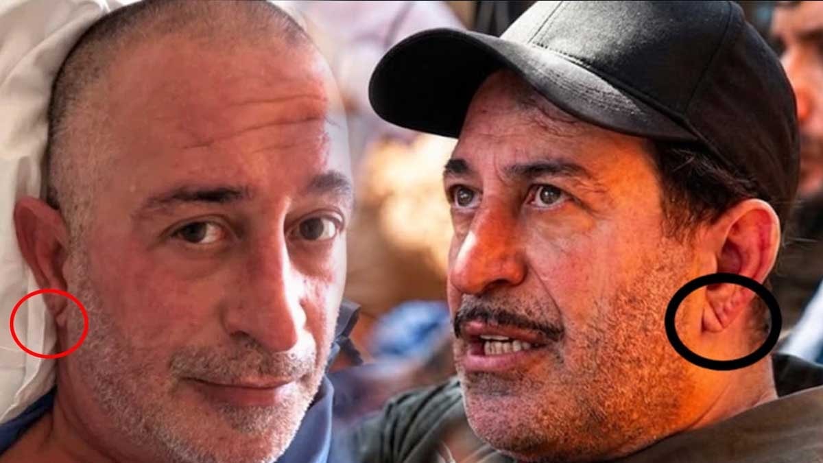 Frank İşareti Kalp Krizi Riskini mi Gösterir