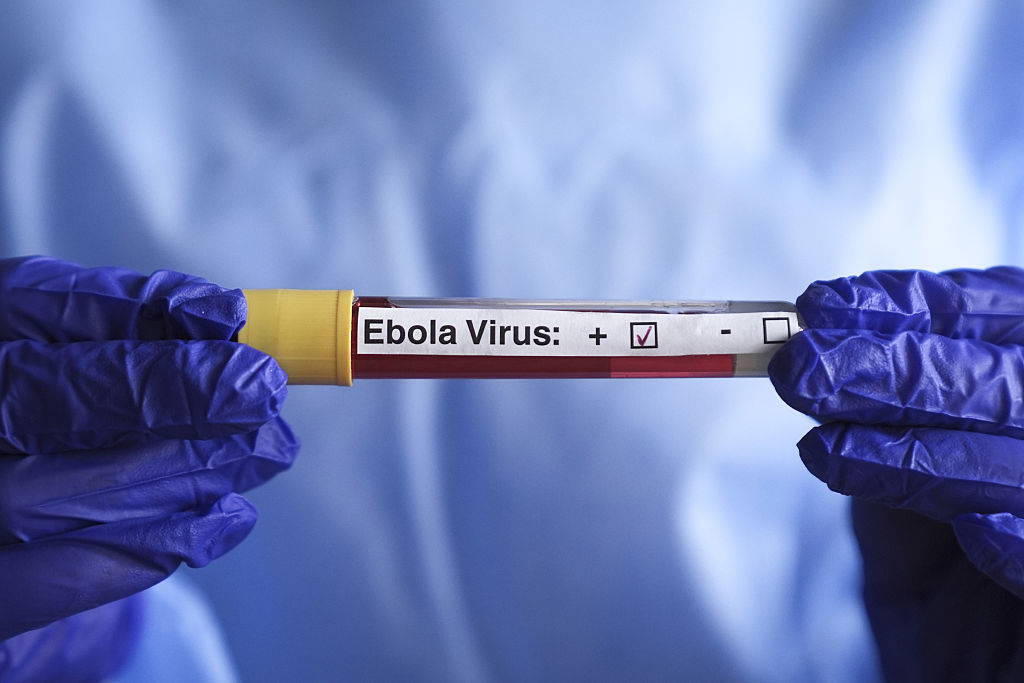 Fransa'da Ebola Alarmı: Ülkeye Giren Doktorda Virüs Tespit Edildi