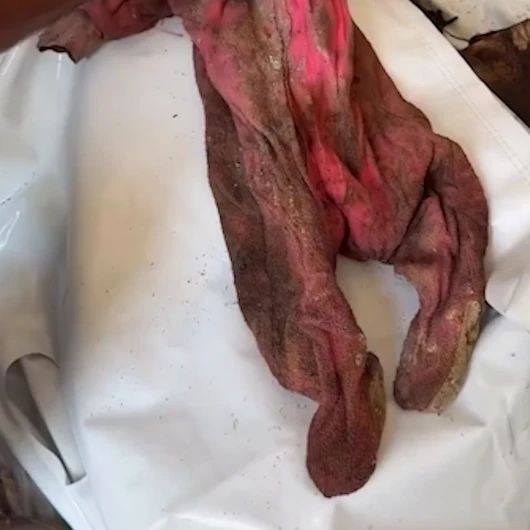 Gazze'de 3 Yıl Sonra Bulunan Bebek Kemikleri Yürek Dağladı