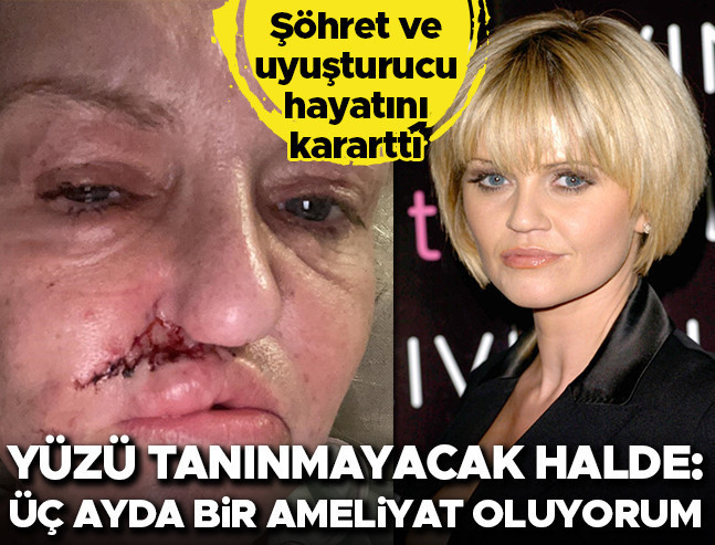 Genç yaşta şöhret, uyuşturucuyla hayatı kararttı: Yüzü tanınmaz halde