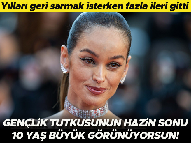 Gençlik takıntısı kabusa döndü: 10 yaş büyük gösteren estetik hataları