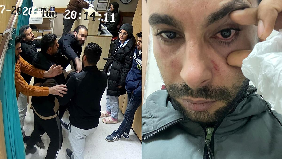 Hatay'da doktorun yumrukladığı hastada yüzde 30 görme kaybı: Sanık doktor için hapis cezası istendi