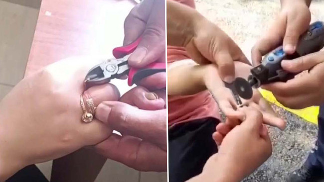 Hatay'da Üç Kişinin Parmağına Sıkışan Yüzükler İtfaiye Tarafından Çıkarıldı