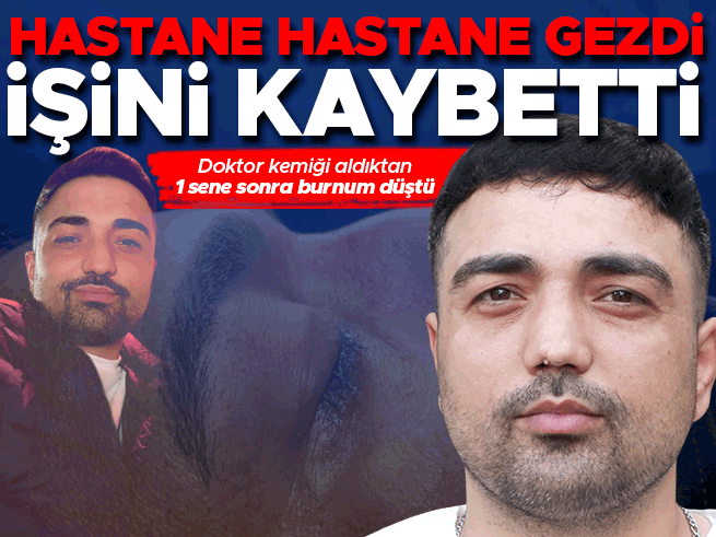 Horlama ameliyatı kabusa döndü: 4 operasyon, iş kaybı