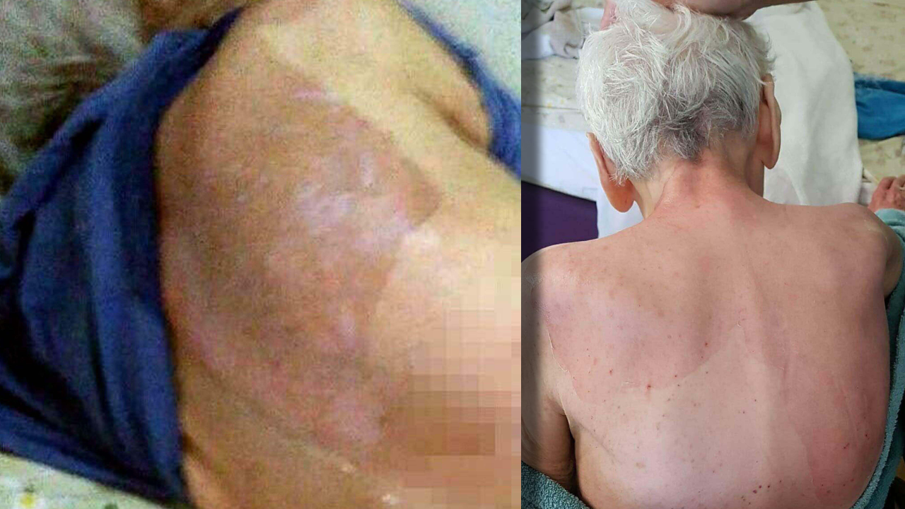 Huzurevinde ölümün cezası taksitle 21 bin TL: Yargıtay bozdu, yeni duruşma