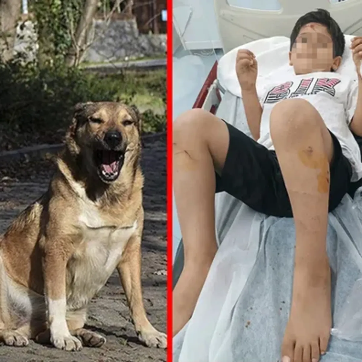 İçişleri Bakanlığı, Viranşehir'deki köpek saldırısını mercek altına aldı