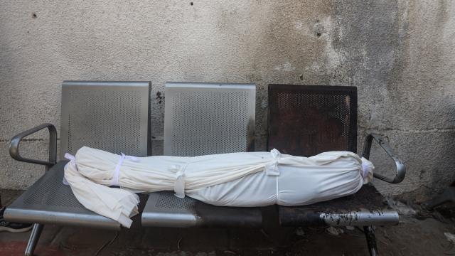 İsrail'in Gazze'deki Saldırılarında Can Kaybı 73 Bin 381'e Ulaştı