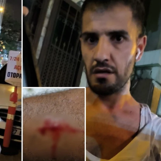 İstanbul'da Kanadalı Turiste Takside Gasp ve Bıçaklı Saldırı