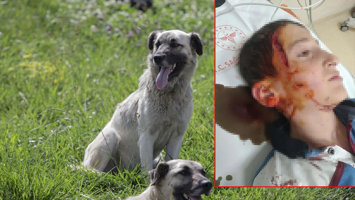 İzmir'deki köpek dehşetine ders gibi ceza: 11 yaşındaki çocuğun yüzünü parçalamıştı