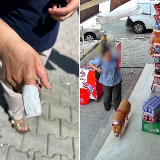 İzmir'de Pitbull Dehşeti: Parmağını Kaybeden Anne Mahkemede Şiirle Adalet Arayacak