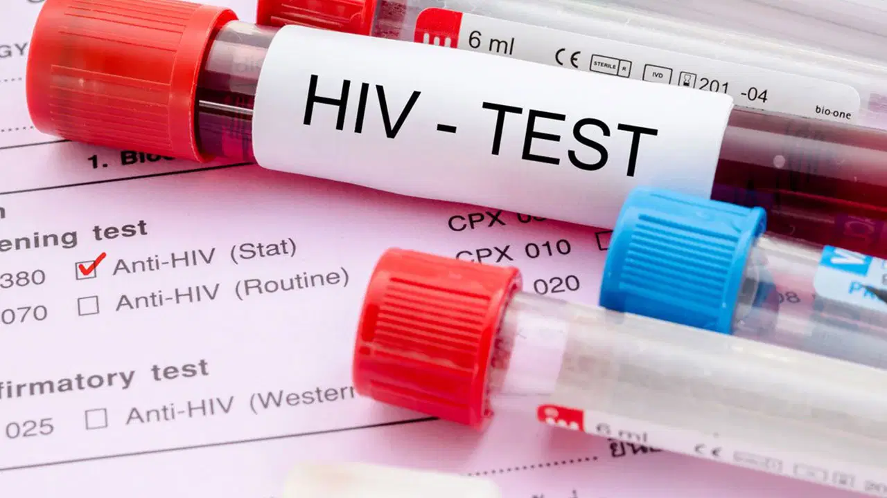 Kadıköy'de ücretsiz anonim HIV testi başladı