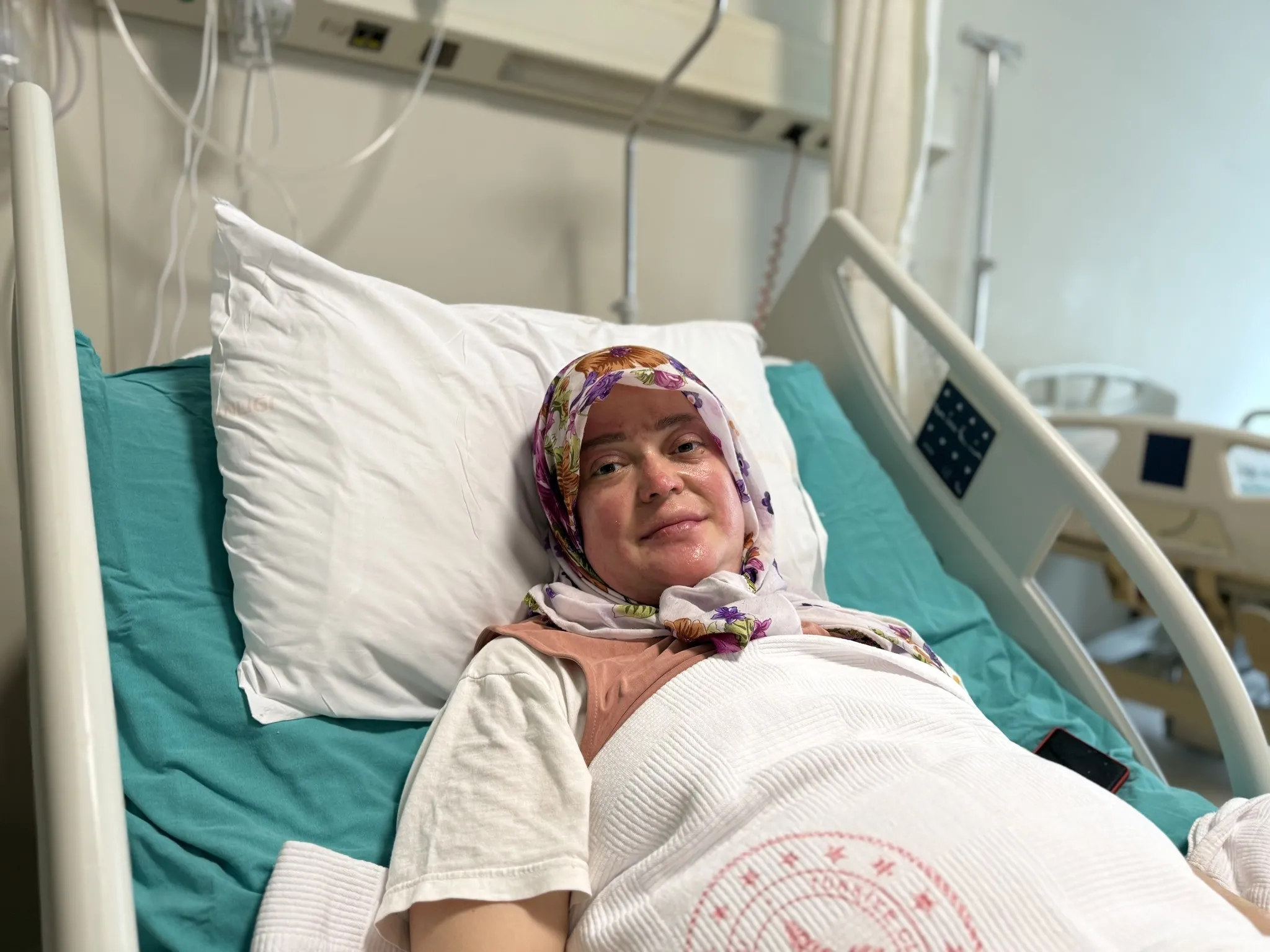 Karavan hayali kabusa döndü: Gaz kaçağı faciası, 20 ameliyatla kurtarıldı