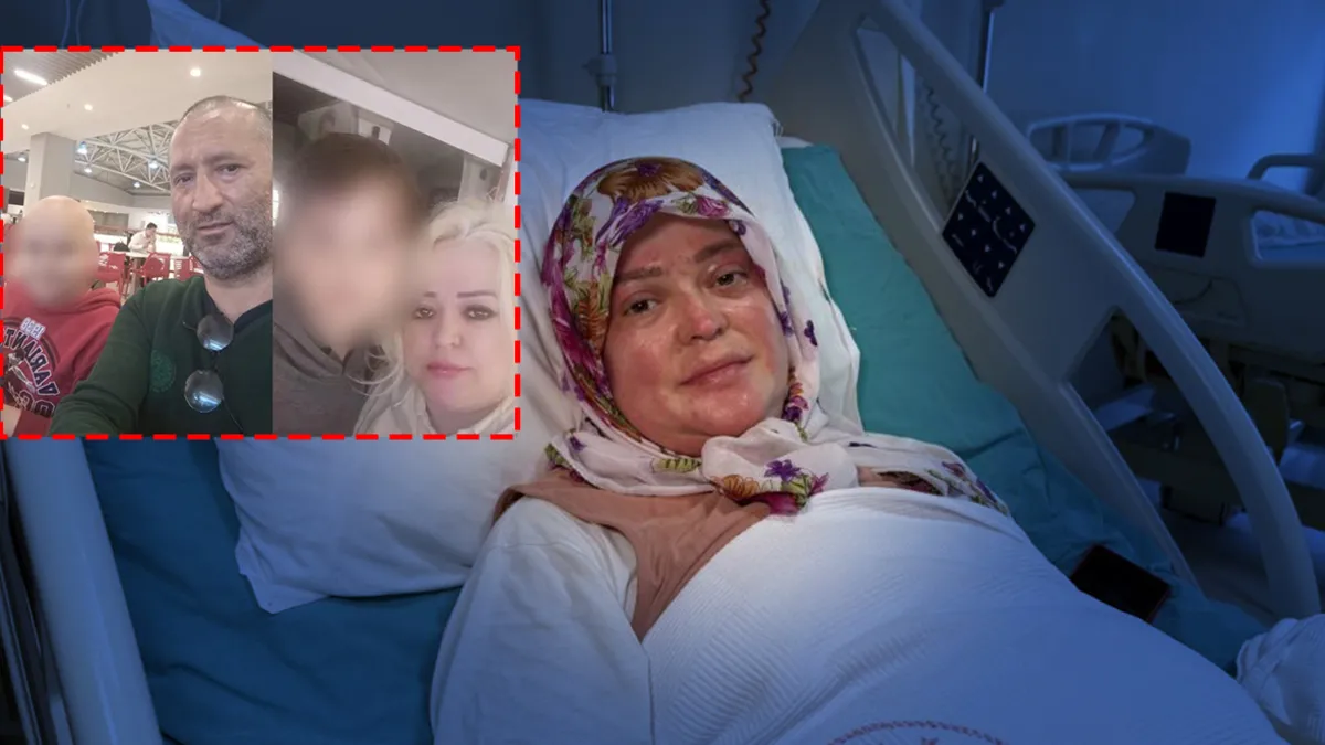 Karavan hayalleri kabusa döndü! Çakmağı çakınca alev aldı: 4 kişilik aile ölümden döndü