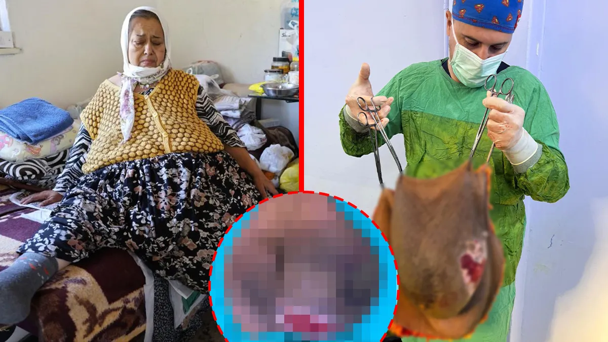 Karnındaki 40 kiloluk kitleyle 8 aylık hamile sanıldı